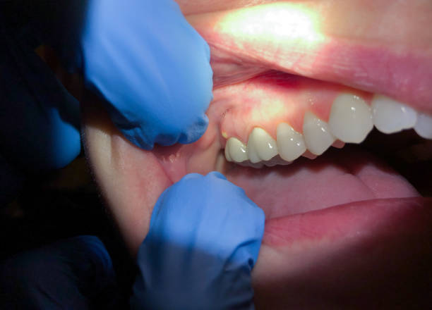Best Urgent Dental Care for Toothache in Atlantic Highlands, NJ