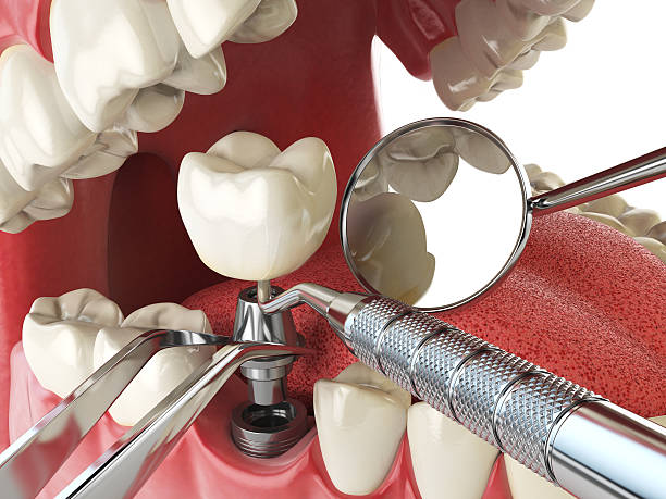 Best Broken or Cracked Tooth Emergency Dentist in Atlantic Highlands, NJ